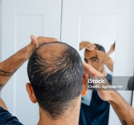 hair loss